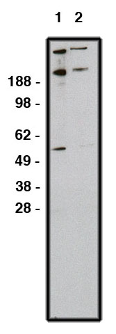 "
Western blot using GLI1 antibody (Cat. No. X2363P) on RMS-13 cell lysate.  Lysate used at 15 µg/lane.  Antibody used at 1:200 (lane 1) and 1:400 (lane 2) dilution.  Secondary antibody, mouse anti-rabbit HRP (Cat. No. X1207M), used at 1:75k dilution."